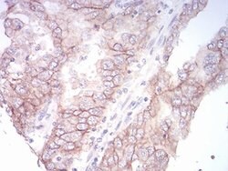 Invitrogen SPHK2 Monoclonal Antibody (3C8D3) 100 μL; Unconjugated:Antibodies,