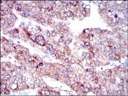 Invitrogen SLC27A5 Monoclonal Antibody (9C4D1) 100 &mu;L; Unconjugated:Antibodies,