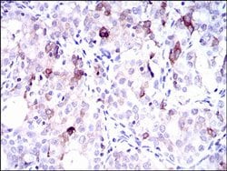 Invitrogen SLC27A5 Monoclonal Antibody (9C4D1) 100 &mu;L; Unconjugated:Antibodies,