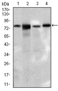 Invitrogen SLC27A5 Monoclonal Antibody (9C4D1) 100 &mu;L; Unconjugated:Antibodies,