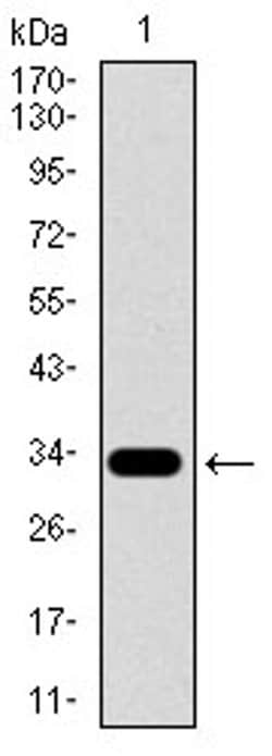 Invitrogen SLC27A5 Monoclonal Antibody (9C4D1) 100 &mu;L; Unconjugated:Antibodies,