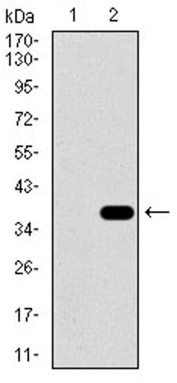 Invitrogen SLC27A5 Monoclonal Antibody (9C4D1) 100 &mu;L; Unconjugated:Antibodies,