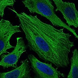 Invitrogen SMCP Monoclonal Antibody (5C10D8) 100 &mu;L; Unconjugated:Antibodies,