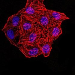 Invitrogen Synapsin 1 Monoclonal Antibody (7B1D9) 100 &mu;L; Unconjugated:Antibodies,