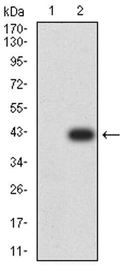 Invitrogen AP2 beta Monoclonal Antibody (6F7G1) 100 &mu;L | Buy Online | Invitrogen&trade; | Fisher Scientific
