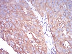 Invitrogen TUBB1 Monoclonal Antibody (2A1A9) 100 &mu;L; Unconjugated:Antibodies,