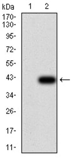 Invitrogen UCP2 Monoclonal Antibody (6C8B3) 100 &mu;L | Buy Online | Invitrogen&trade; | Fisher Scientific