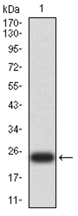 Invitrogen UCP3 Monoclonal Antibody (6B8C6) 100 &mu;L; Unconjugated:Antibodies,