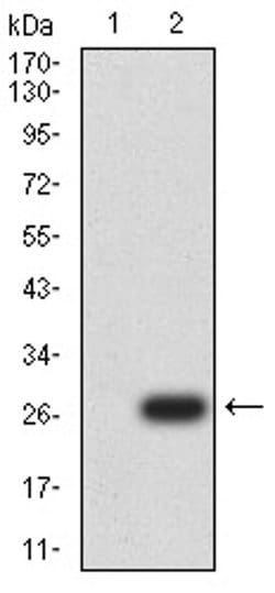 Invitrogen UCP3 Monoclonal Antibody (6B8C6) 100 &mu;L; Unconjugated:Antibodies,