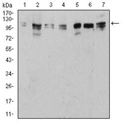 Invitrogen ULK2 Monoclonal Antibody (2H4B2) 100 &mu;L | Buy Online | Invitrogen&trade; | Fisher Scientific