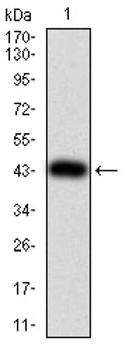 Invitrogen ULK2 Monoclonal Antibody (2H4B8) 100 &mu;L; Unconjugated:Antibodies,