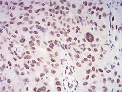 Invitrogen XRN2 Monoclonal Antibody (7C5B10) 100 &mu;L; Unconjugated:Antibodies,