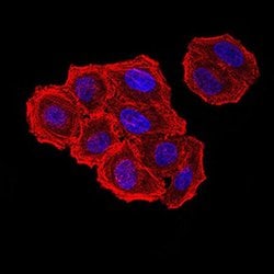 Invitrogen ZFP91 Monoclonal Antibody (8C3D5) 100 &mu;L; Unconjugated:Antibodies,