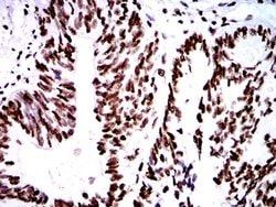 Invitrogen ZFP91 Monoclonal Antibody (8C3D5) 100 &mu;L; Unconjugated:Antibodies,