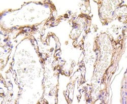 Invitrogen LRP1 Recombinant Rabbit Monoclonal Antibody (SA0290) 100 &mu;L;
