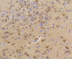 Invitrogen HSP70 Recombinant Rabbit Monoclonal Antibody (SA0379) 100 &mu;L;