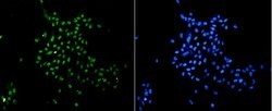 Invitrogen H3K18me1 Recombinant Rabbit Monoclonal Antibody (SA42-07) 100