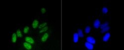 Invitrogen H3K18me1 Recombinant Rabbit Monoclonal Antibody (SA42-07) 100