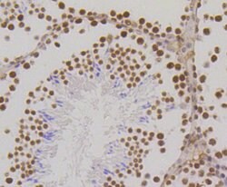 Invitrogen H3K18me1 Recombinant Rabbit Monoclonal Antibody (SA42-07) 100