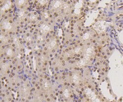 Invitrogen H3K18me1 Recombinant Rabbit Monoclonal Antibody (SA42-07) 100