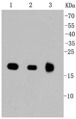 Invitrogen Pan Ras Recombinant Rabbit Monoclonal Antibody (SA39-05) 100 &mu;L | Buy Online | Invitrogen&trade; | Fisher Scientific