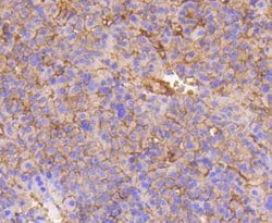 Invitrogen Integrin beta 1 (CD29) Recombinant Rabbit Monoclonal Antibody