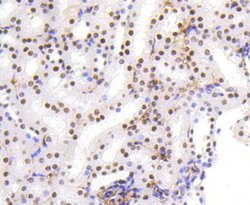 Invitrogen HMGB1 Recombinant Rabbit Monoclonal Antibody (SA39-03) 100 &mu;L;