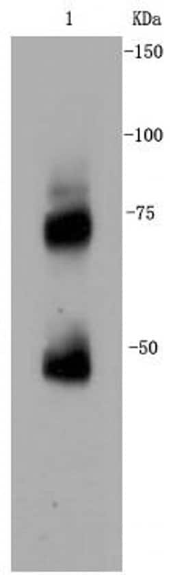 Invitrogen CD271 (NGF Receptor) Recombinant Rabbit Monoclonal Antibody (SA39-02) 100 &mu;L | Buy Online | Invitrogen&trade; | Fisher Scientific