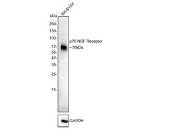 Invitrogen CD271 (NGF Receptor) Recombinant Rabbit Monoclonal Antibody (SA39-02) 100 &mu;L | Buy Online | Invitrogen&trade; | Fisher Scientific