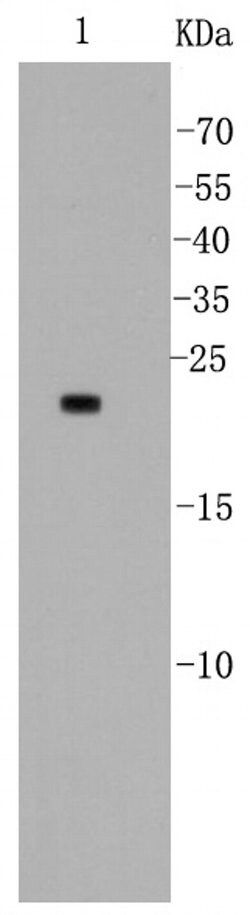 Invitrogen BAD Recombinant Rabbit Monoclonal Antibody (SA32-01) 100 &mu;L;