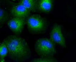 Invitrogen COL17A1 Recombinant Rabbit Monoclonal Antibody (SR46-05) 100