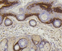 Invitrogen COL17A1 Recombinant Rabbit Monoclonal Antibody (SR46-05) 100