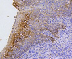 Invitrogen Cytokeratin 17 Recombinant Rabbit Monoclonal Antibody (SR45-06) 100 &mu;L | Buy Online | Invitrogen&trade; | Fisher Scientific