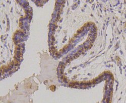 Invitrogen Cytokeratin 17 Recombinant Rabbit Monoclonal Antibody (SR45-06) 100 &mu;L | Buy Online | Invitrogen&trade; | Fisher Scientific