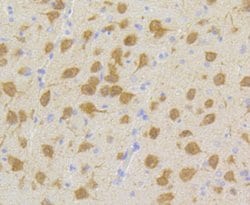 Invitrogen CDK5 Recombinant Rabbit Monoclonal Antibody (SR39-01) 100 &mu;L;