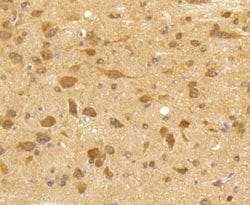 Invitrogen CDK5 Recombinant Rabbit Monoclonal Antibody (SR39-01) 100 &mu;L;