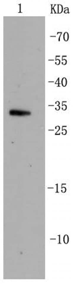 Invitrogen CDK5 Recombinant Rabbit Monoclonal Antibody (SR39-01) 100 &mu;L;