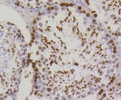 Invitrogen Phospho-Histone H2A.X (Ser139) Recombinant Rabbit Monoclonal