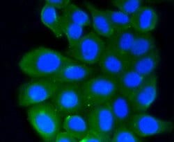 Invitrogen RhoA/RhoB/RhoC Recombinant Rabbit Monoclonal Antibody (SR38-00) 100 &mu;L | Buy Online | Invitrogen&trade; | Fisher Scientific