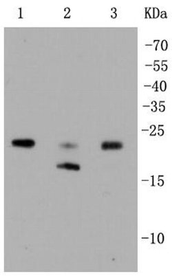 Invitrogen RhoA/RhoB/RhoC Recombinant Rabbit Monoclonal Antibody (SR38-00) 100 &mu;L | Buy Online | Invitrogen&trade; | Fisher Scientific