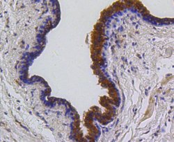 Invitrogen PUMA alpha Recombinant Rabbit Monoclonal Antibody (SR42-09)
