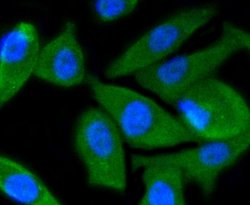 Invitrogen PI3K p55 gamma Recombinant Rabbit Monoclonal Antibody (SR44-06)