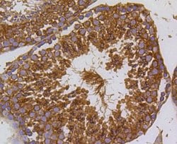 Invitrogen PI3K p55 gamma Recombinant Rabbit Monoclonal Antibody (SR44-06)