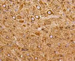 Invitrogen PI3K p55 gamma Recombinant Rabbit Monoclonal Antibody (SR44-06)