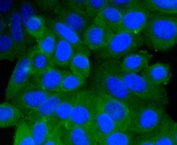 Invitrogen Prohibitin Recombinant Rabbit Monoclonal Antibody (SR46-02) 100 &mu;L | Buy Online | Invitrogen&trade; | Fisher Scientific