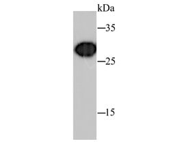 Invitrogen Prohibitin Recombinant Rabbit Monoclonal Antibody (SR46-02) 100 &mu;L | Buy Online | Invitrogen&trade; | Fisher Scientific