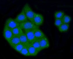 Invitrogen SR-BI Recombinant Rabbit Monoclonal Antibody (SR37-06) 100 &mu;L;