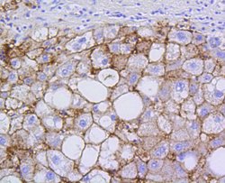 Invitrogen SR-BI Recombinant Rabbit Monoclonal Antibody (SR37-06) 100 &mu;L;