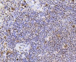 Invitrogen SR-BI Recombinant Rabbit Monoclonal Antibody (SR37-06) 100 &mu;L;