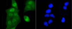 Invitrogen H2AK9ac Recombinant Rabbit Monoclonal Antibody (SR4-15) 100